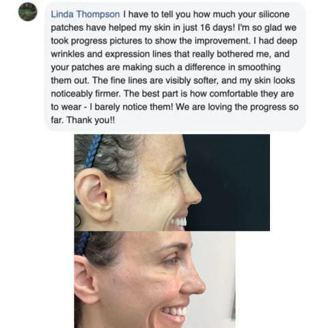 Velora Beauty® - Silicone Wrinkle & Scar Sheets