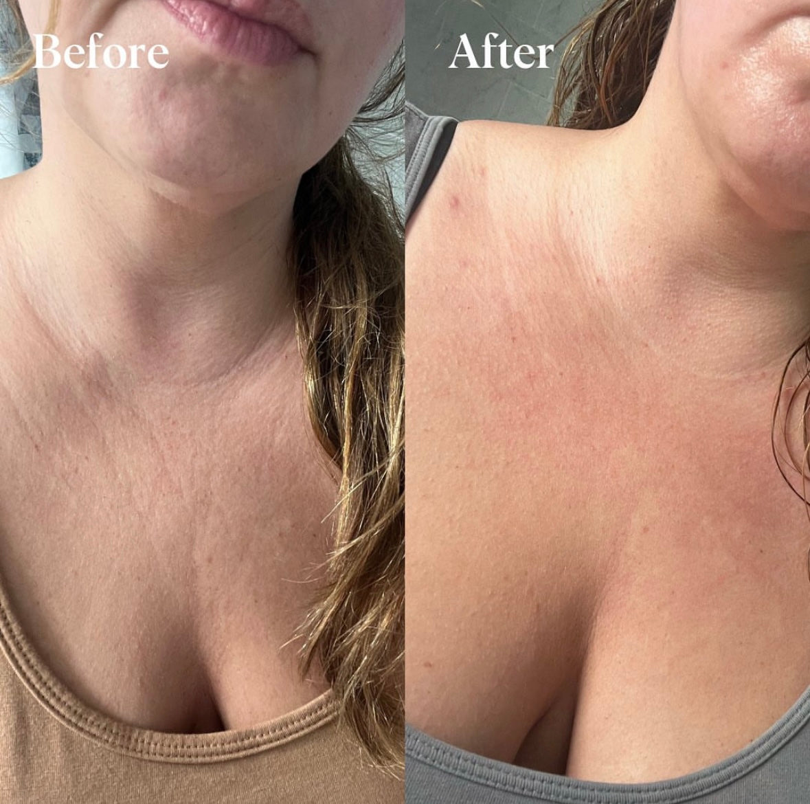 Velora Beauty® - Silicone Wrinkle & Scar Sheets