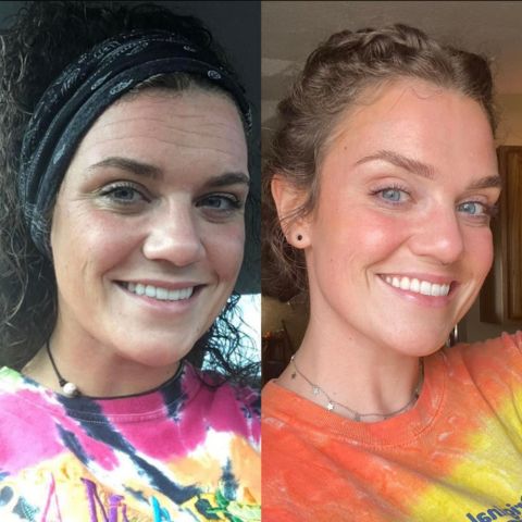 Velora Beauty® - Silicone Wrinkle & Scar Sheets